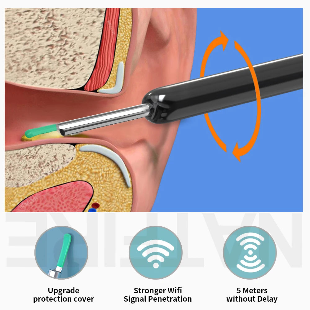 NovaScope™ Smart Ear Cleaner